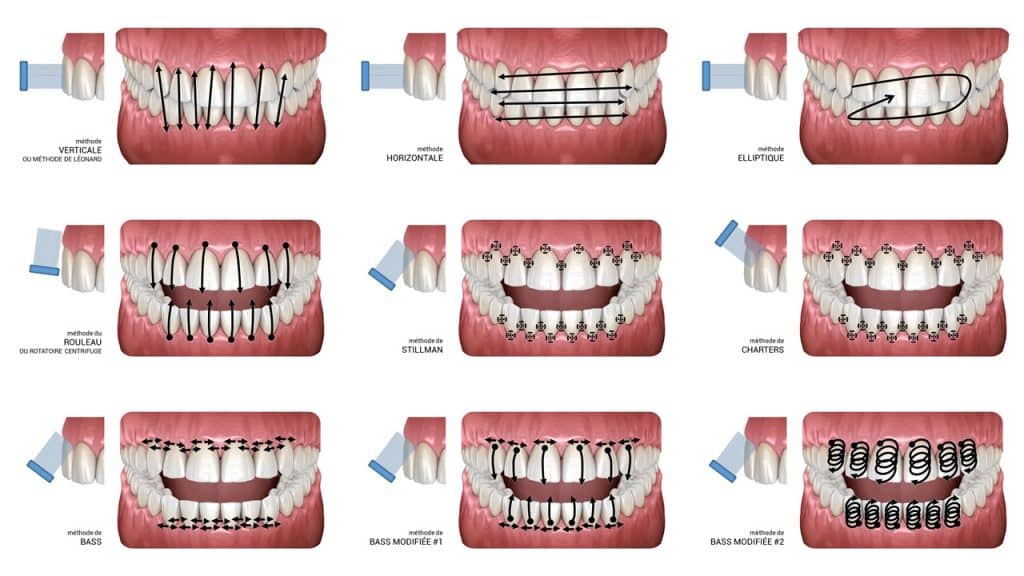 Principales techniques de brossage des dents