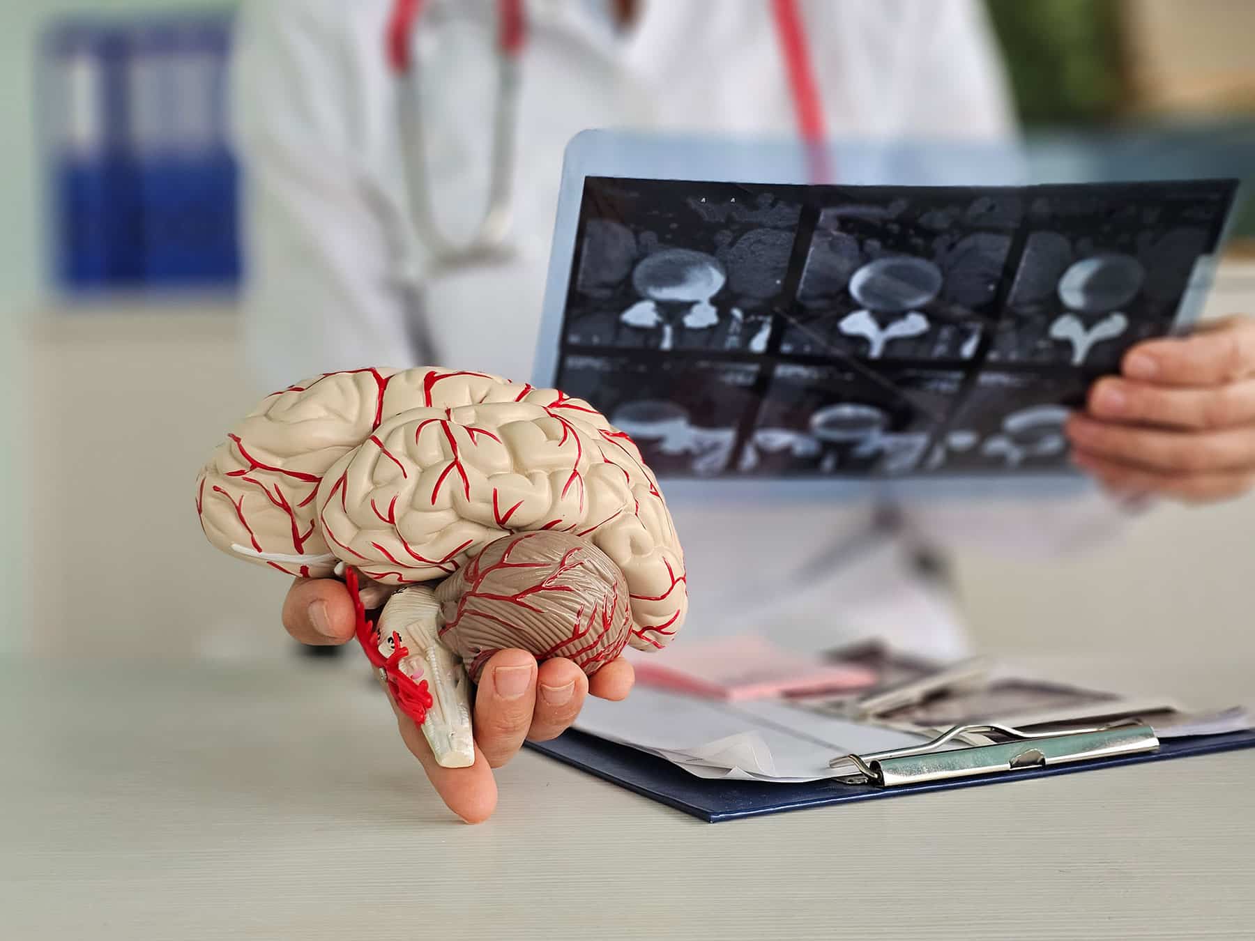 formation-maladie-alzheimer